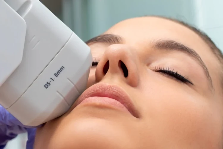 HIFU+Facial+Treatment.jpg.webp
