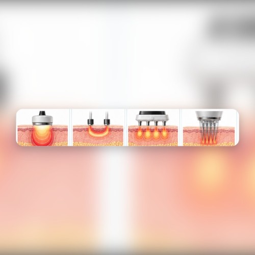rf-technologies-monopolar-bipolar-multipolar-microneedling.jpg